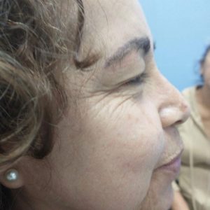 Suero DETOX - Imagen 11